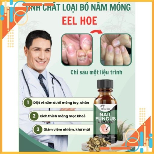 Tinh chất EEL HOE - EEL HOE giảm viêm nấm móng chân tay