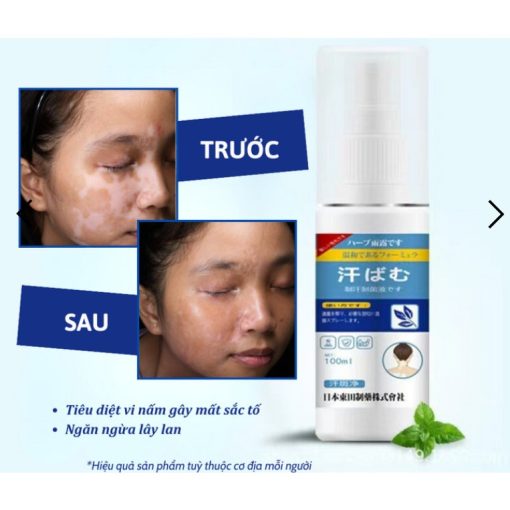 XỊT BẠCH BIẾN CỔ TRUYỀN NHẬT BẢN