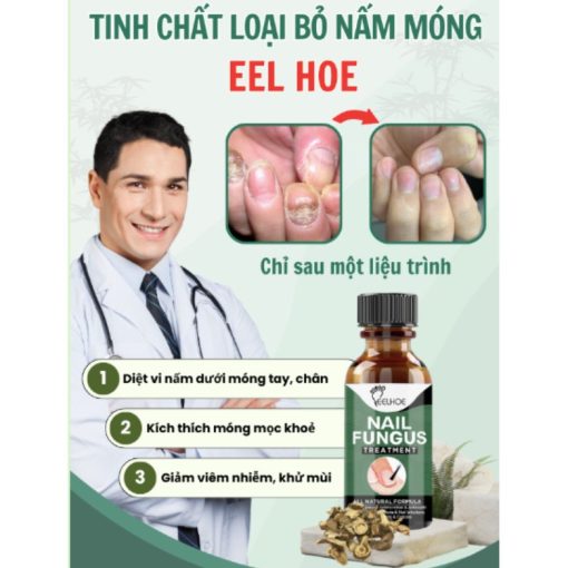 Tinh chất EELHOE - NAIL FUNGUS giảm viêm nấm móng chân tay